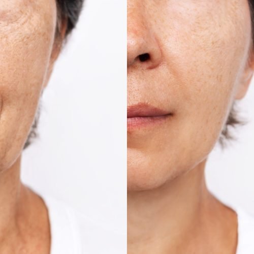 facefiler1-min